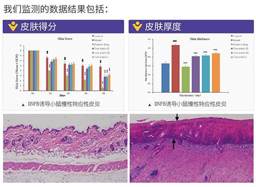 龙8-long8建立的特应性皮炎及湿疹模型监测数据结果