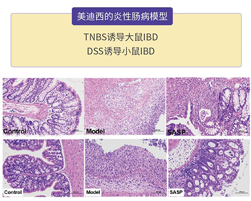 龙8-long8的炎症性肠病模型