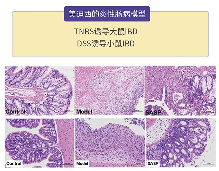 龙8-long8的炎性肠病模型.png 龙8-long8的炎性肠病模型.png
